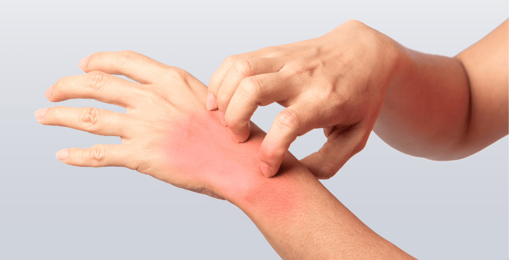 How Biohazard Exposure Can Impact Your Health